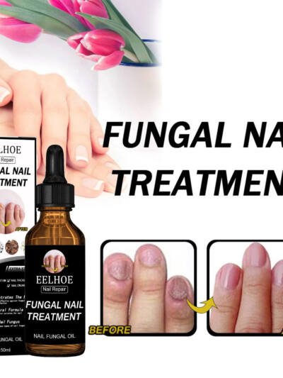 EELHOE Nail Repair Solution Thickening And Shining Nail Removal Dead Skin Repairing And Moisturizing Nail Nutritional Care Liquid